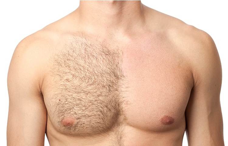 How Should Men Remove Body Hair