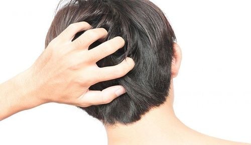 What Causes Scalp Folliculitis?