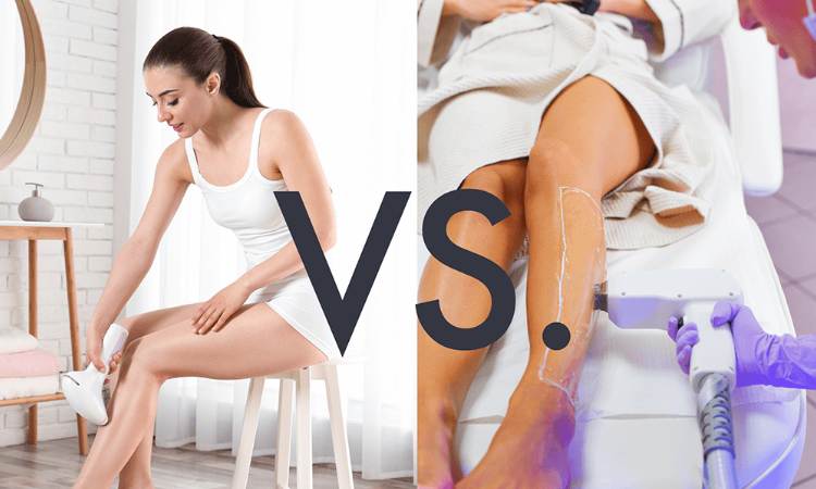 At-Home vs. Professional Laser Hair Removal. Which device works better