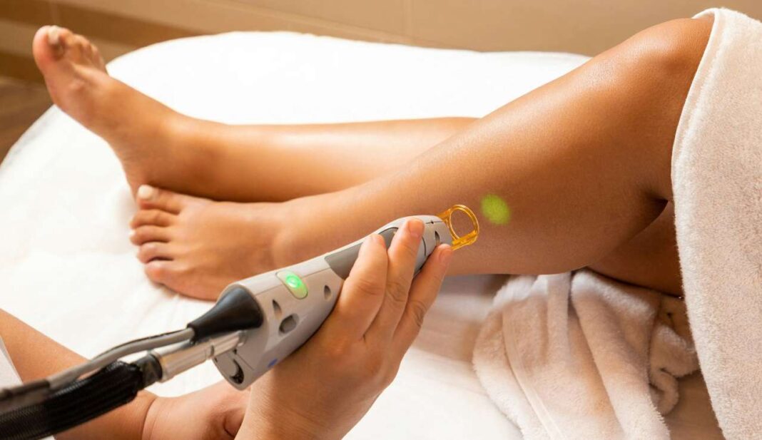 Laser Hair Removal