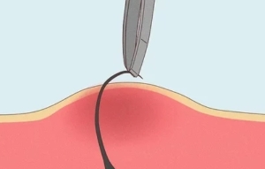 Minimized Ingrown Hairs