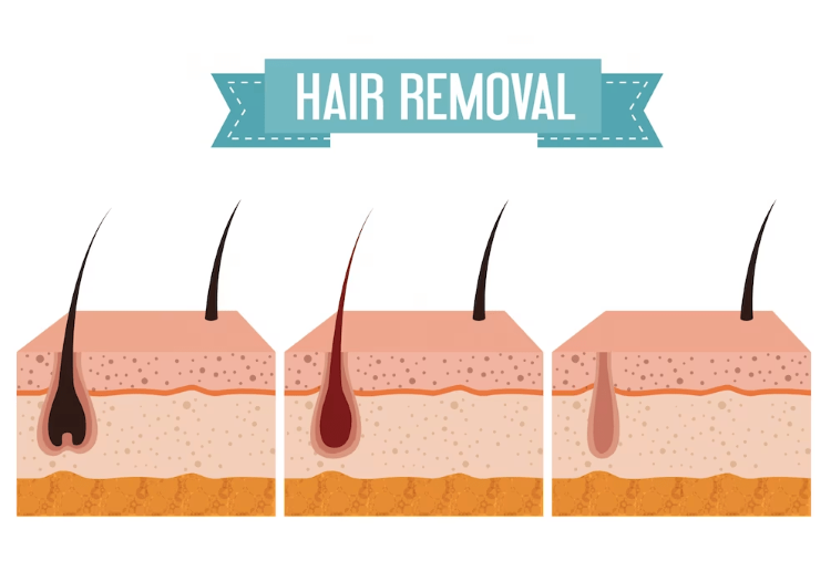 hair Removal