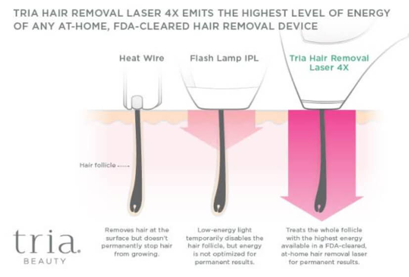 How to Use Tria Laser Hair Removal Device? (& How Often)