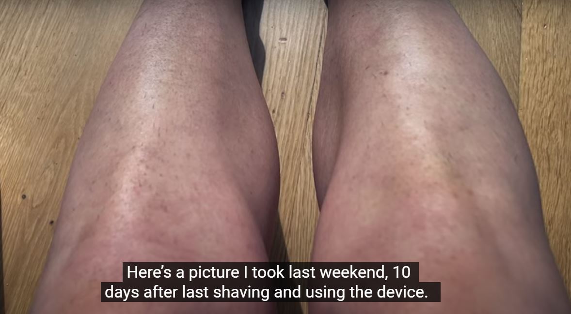 10 days after shaving